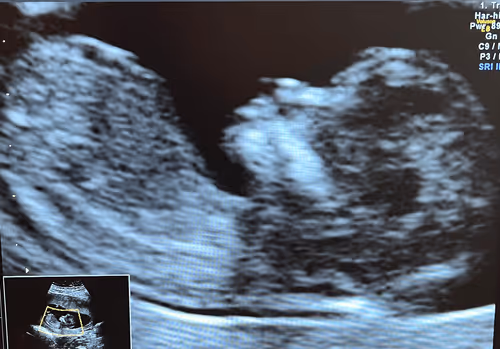 Item #114095649019266290657089219442460875487858516691417694846003442764554516299777 Media