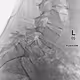 X-RAYS V2