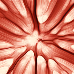 332