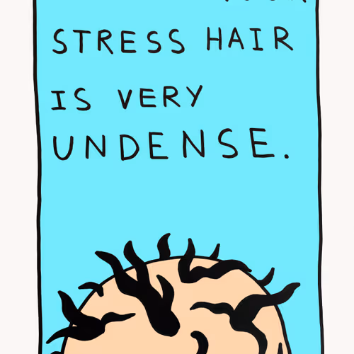 SO UNDENSE