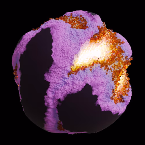 Asm Gen Ii Brains