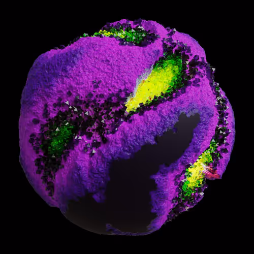Asm Gen Ii Brains