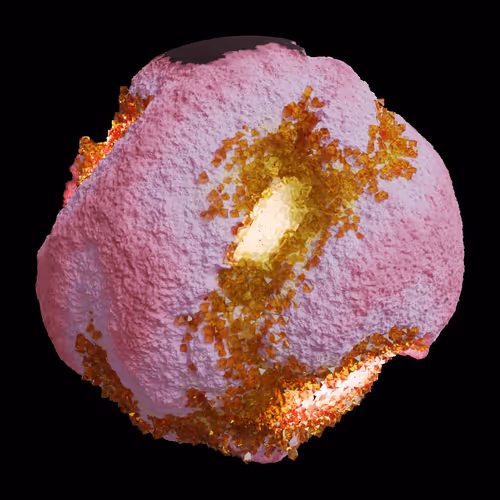 Asm Gen Ii Brains