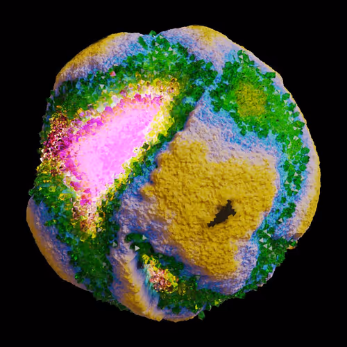Asm Gen Ii Brains