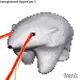 923