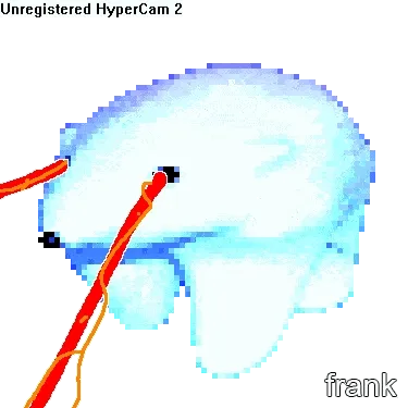 Frankfrank