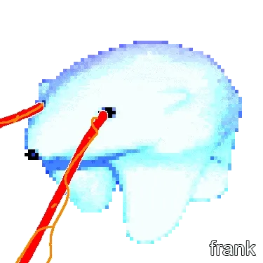 Frankfrank