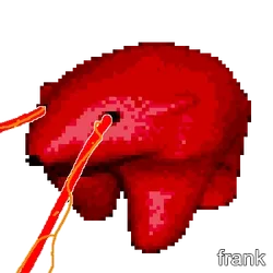 frank