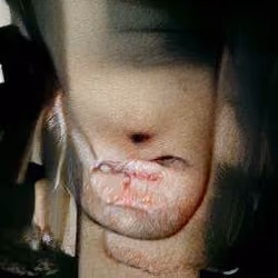 Subhuman #1601