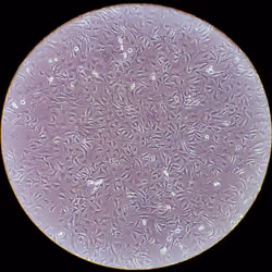 Human cells under a lens
