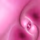 394000077