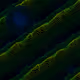 142000775