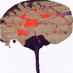 100 iq
