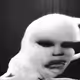 524