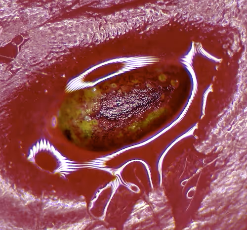 The Interfered Microscopy Plot By Golan Levin