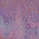 2000104