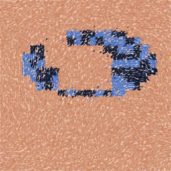 37