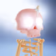 278