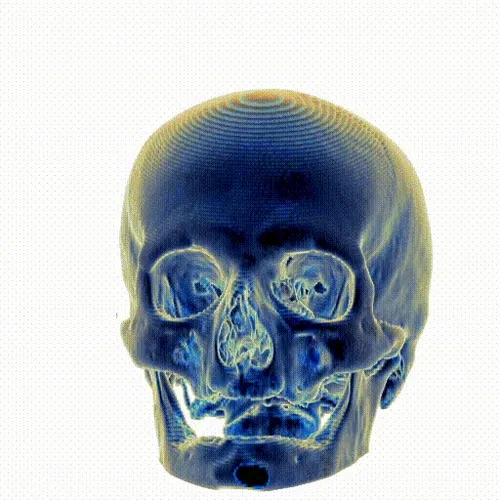 Xradiare