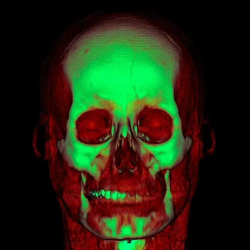 Xradiare