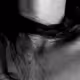 A body, a dream, a regret