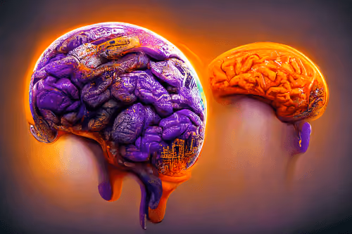 Brain #158