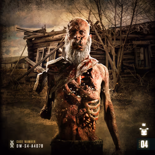 Twd Degenerative Stage 4b