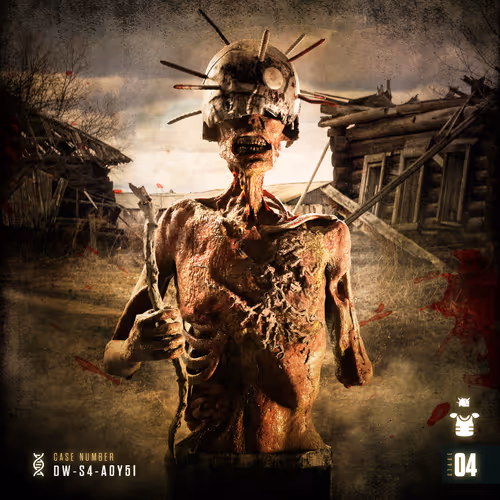 Twd Degenerative Stage 4b