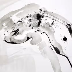 35