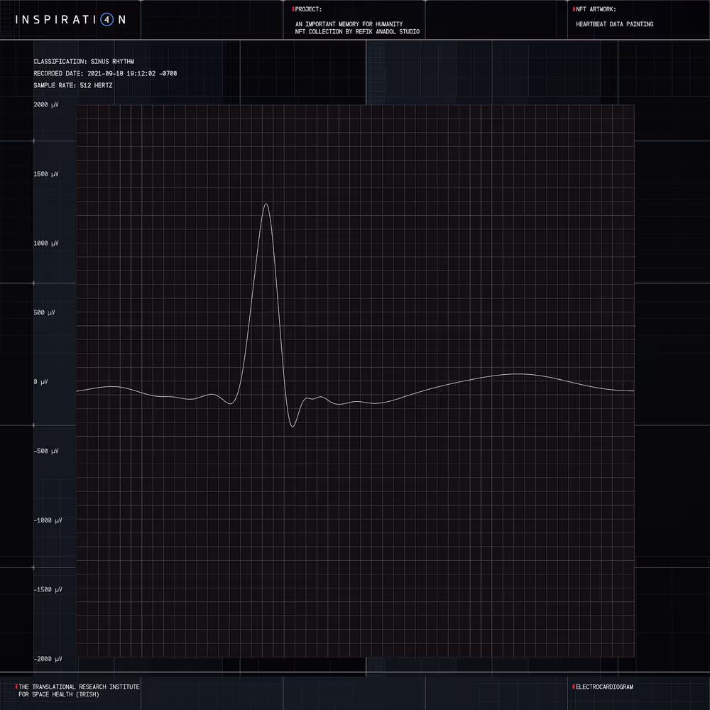 HEARTBEAT DATA PAINTING #1883