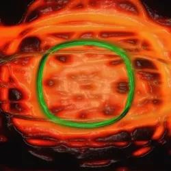 92