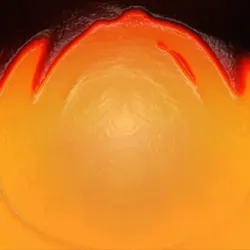 99