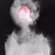 79