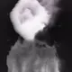 87