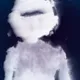 91