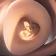 318