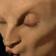 77