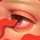 87