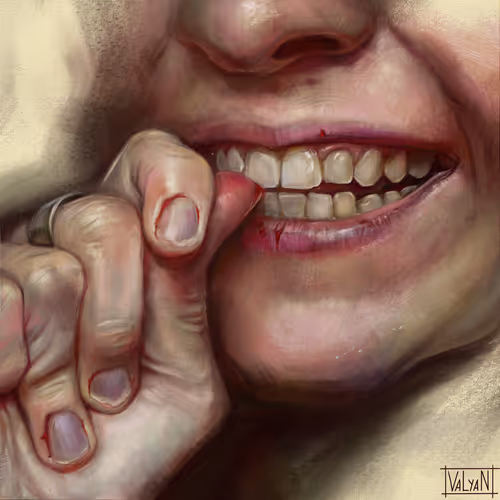 Anxiety 10