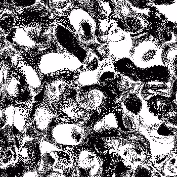 Noise #997 