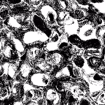 Noise #997 