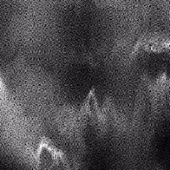 Noise #103 