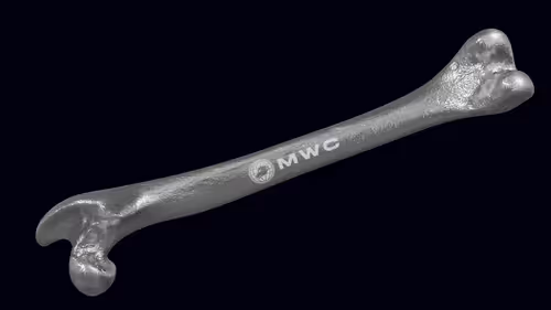 Mwcbones