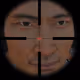 15xScope