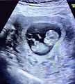 Baby Ellie Monster - old