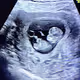 Baby Ellie Monster - old