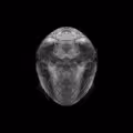 Oocytes
