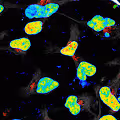 Neural Stem Cells