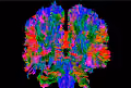 (EEG)  8 - 12 MHz