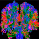 (EEG)  8 - 12 MHz